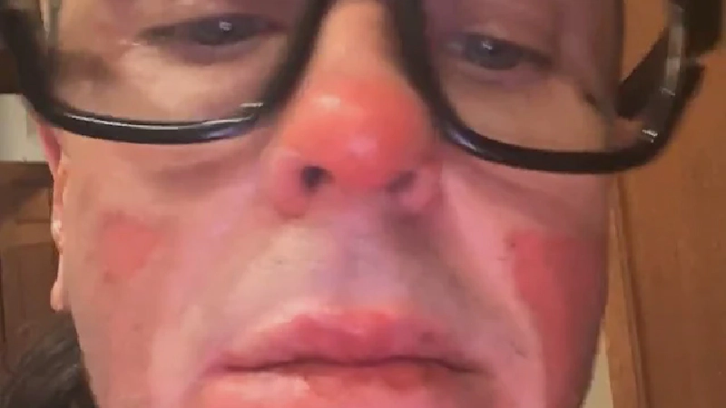 Sid Wilson do Slipknot Fala sobre Recuperação Após Grave Acidente