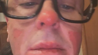 Sid Wilson do Slipknot Fala sobre Recuperação Após Grave Acidente